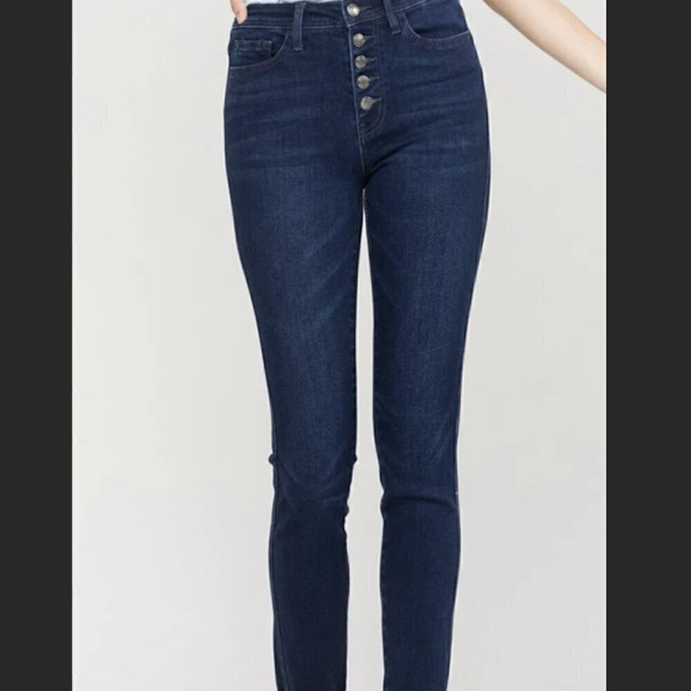 Free People Button Fly High Rise Dark Wash Jeans Sz 27